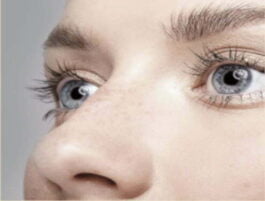 rinoplastia